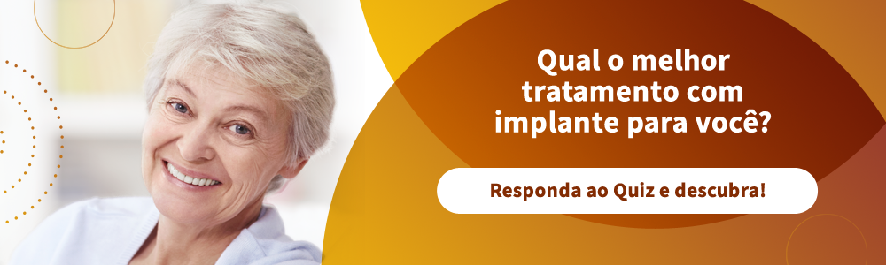 Responda ao Quiz e saiba qual o melhor tratamento de Implantes para você!
